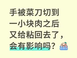 手指被刀切掉一块肉 “粘回去”有用吗