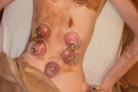 库兹马未婚妻社媒晒两人度假照 体验了一把中式拔罐