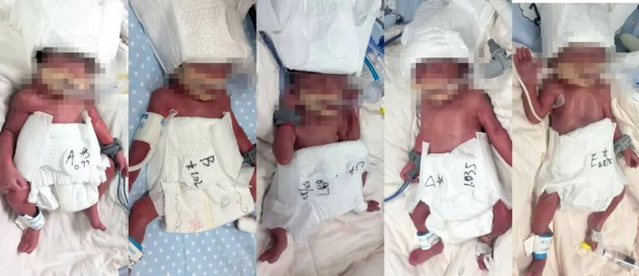 △出生时的五胞胎。(受访单位供图)