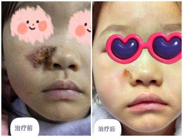 受伤女童。图源：湖南交通频道 