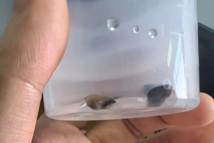 宝宝气道异物示意图