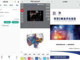 国产医学影像三维重建新品：阿梵D如何用“AI+临床”打破进口垄断