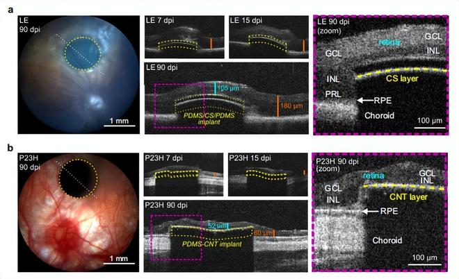 图丨体内光声植入物生物相容性研究（来源：Nature Communication