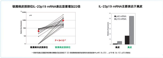 图1 IL-23p19在银屑病皮损部位显著增加,且更多表达于真皮层