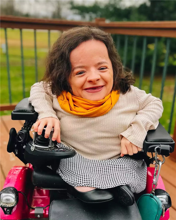 比较严重的达维特（时尚美妆博主）