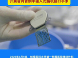 安徽省首例半侵入式脑机接口植入手术成功，患者有望重获抓、握、捏等左手精准运动功能