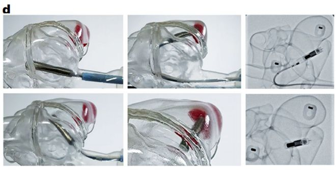 （来源：https://doi.org/10.1038/s41551-025-01604-4）