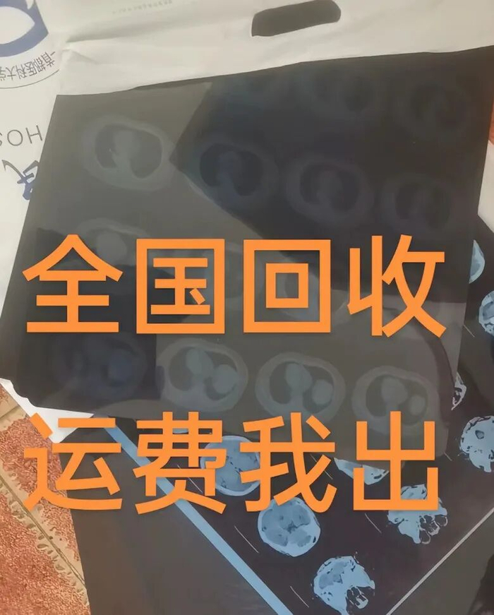 △视频平台上回收CT胶片内容