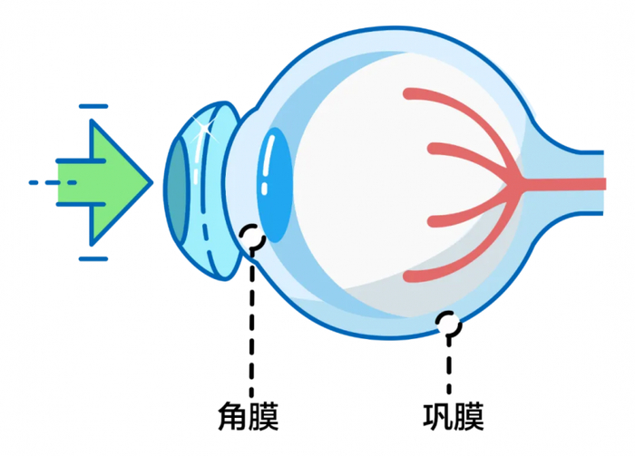 眼球结构示意图