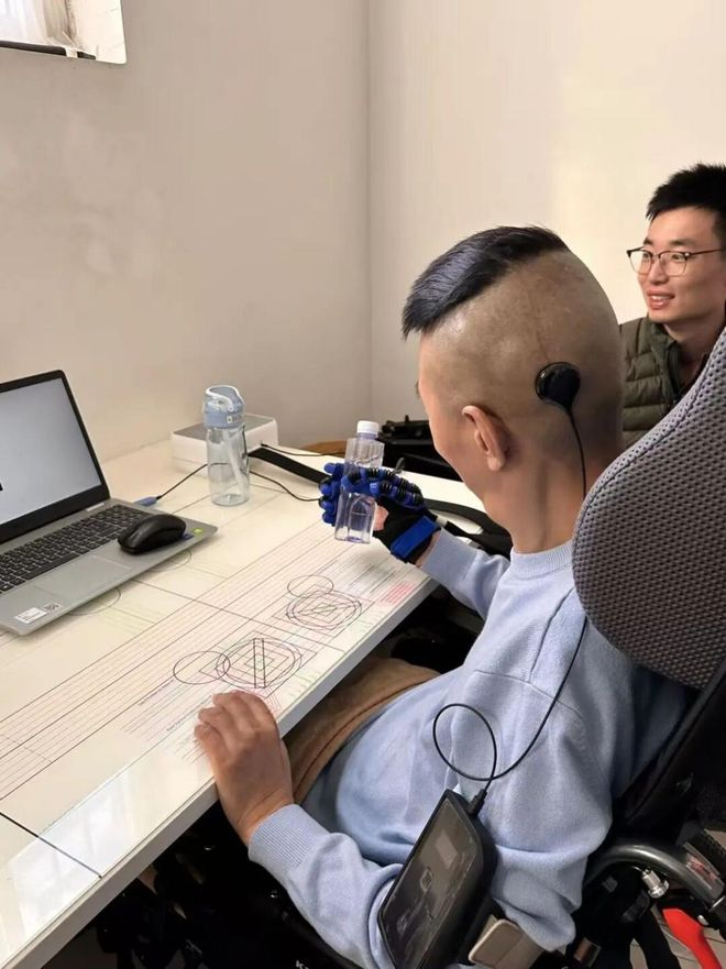 ▲临床试验中，截瘫患者实现脑控抓握。图源：清华大学