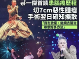 知名歌手自曝脑癌已扩散