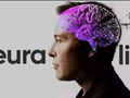 马斯克Neuralink推手术机器人：脑机芯片植入时间更短了