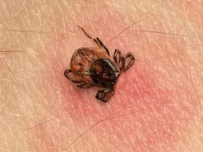 （“埋头苦干”的蜱虫，图片来源于网络）