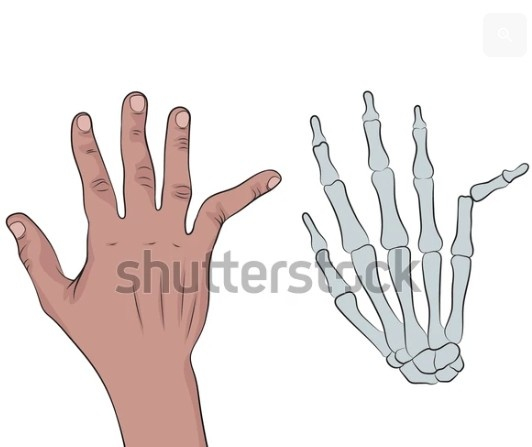 右手尾指完全脱臼示意图（图源：Shutterstock）