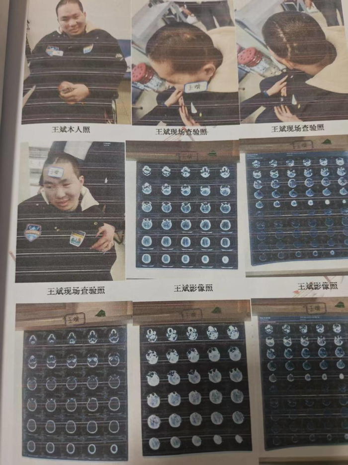 ▲王斌鉴定伤情的查验照片