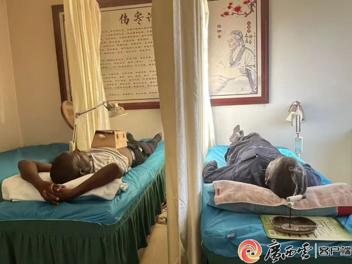 非洲游客体验艾灸。阳朔县人民医院供图