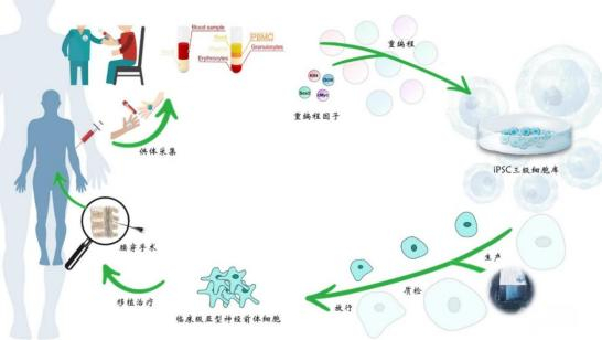 异体通用型iPSC衍生细胞疗法治疗ALS大致流程示意图
