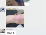 “小龙女粉丝群攻击小酷？对小酷指责谩M！三楼摔下受伤！小酷让她解散所有群！”