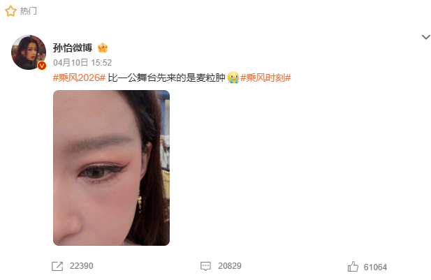 孙怡晒一公前得麦粒肿