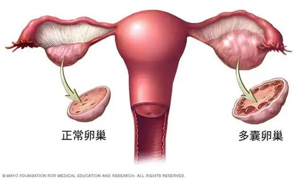 图片来源：Mayo Clinic