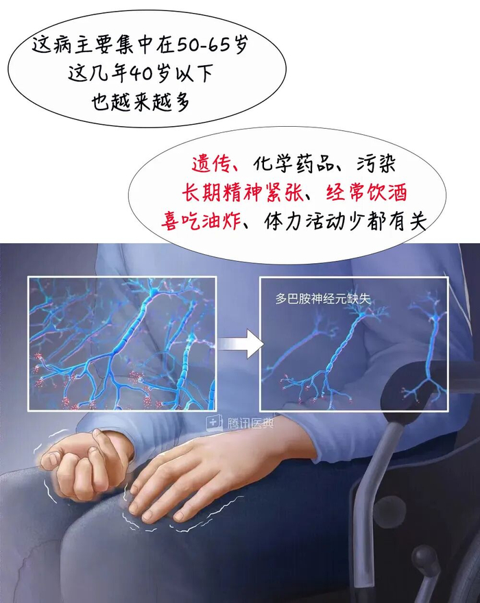 来源：腾讯医典
