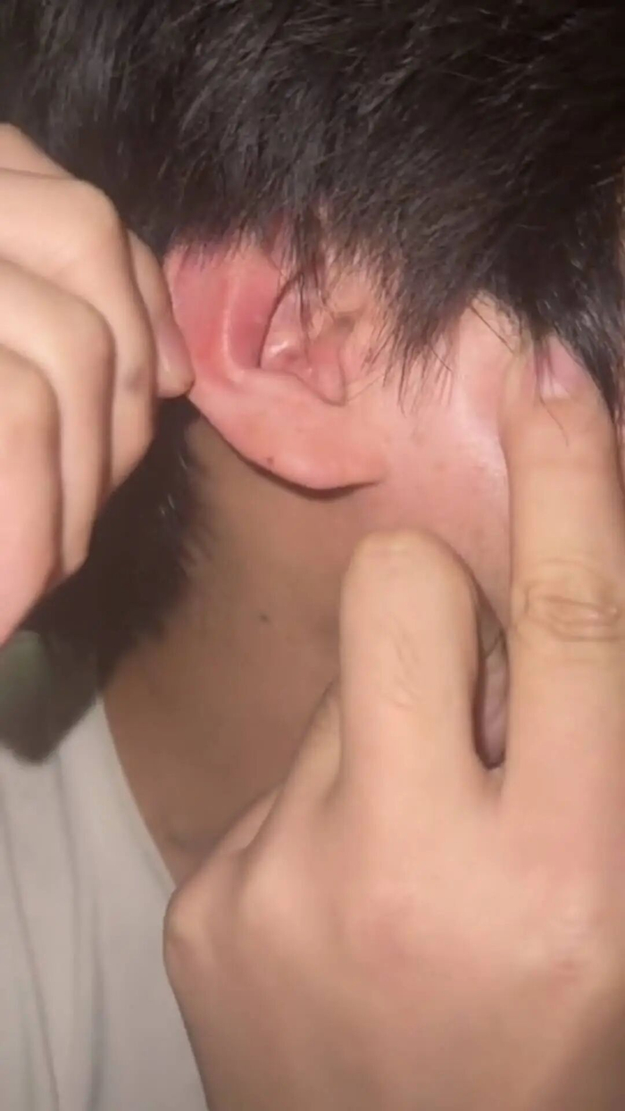 事发后小孙右耳有轻微的耳鸣和灼烧感，目前已无大碍（图据受访者）