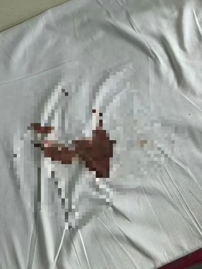△张女士弄脏的床单。图源/极目新闻。
