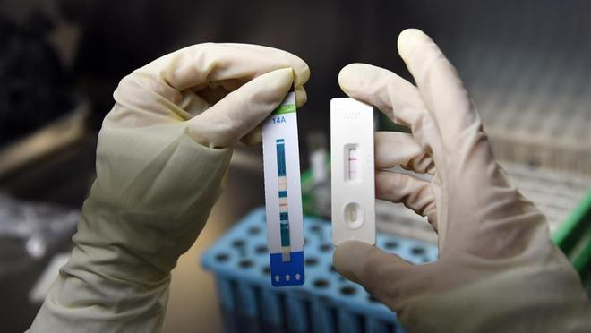 医生使用HIV抗体的快速试剂进行检测（图片来源：新华社）
