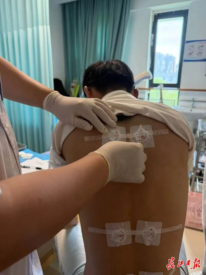 医生正在为小吴敷三伏贴。记者赵萌萌 摄
