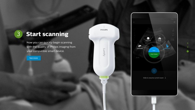 飞利浦Lumify便携式超声诊断系统图源：Lumify产品销售网站