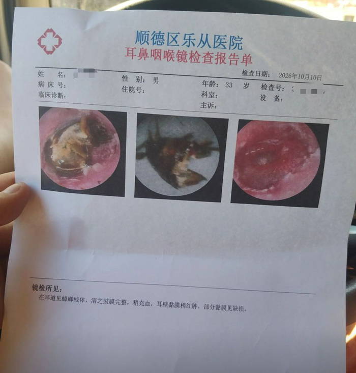 检查报告单。图/受访者提供