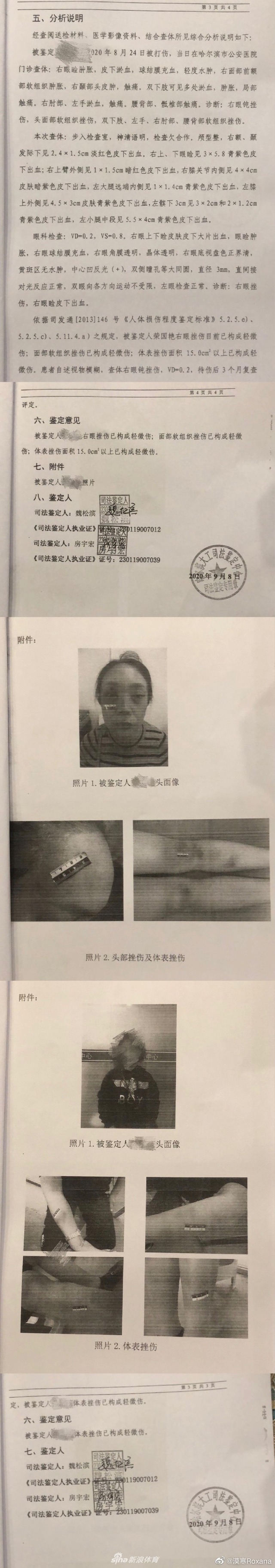 张培萌妻子晒遭家暴证据