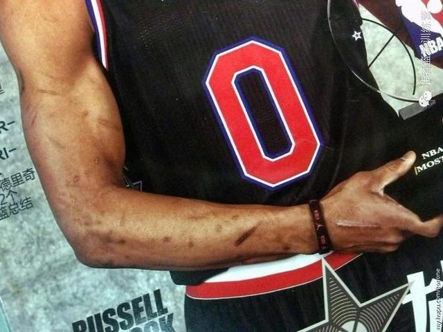 科比跟腱让人心疼 威少胳膊触目惊心_新浪图片