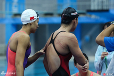 傅园慧后背脑门道道血痕惹人心疼