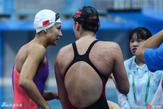 傅园慧后背脑门道道血痕惹人心疼