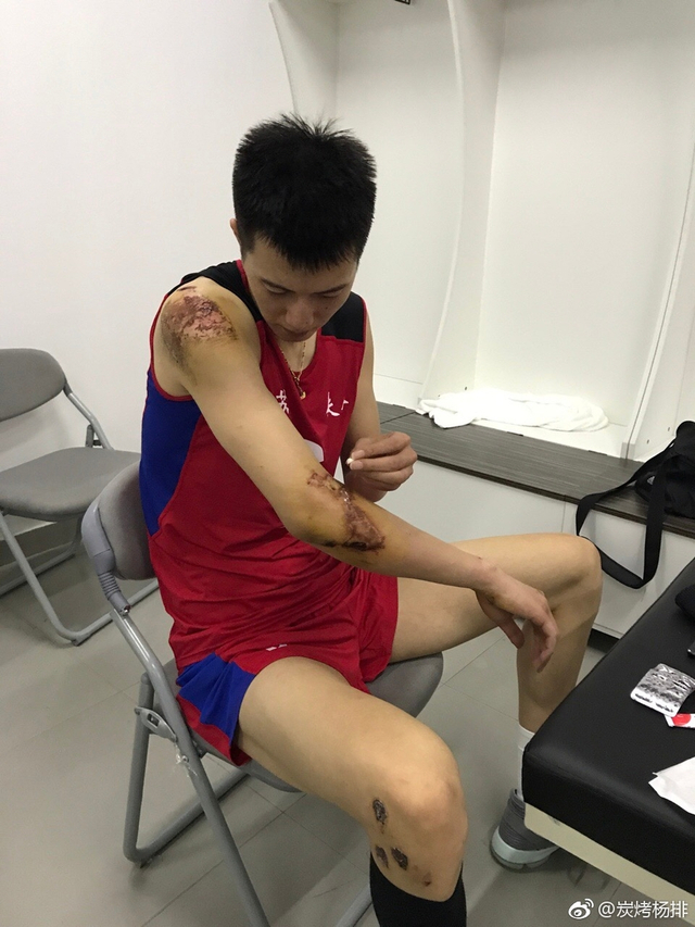 张晨全身多处擦伤