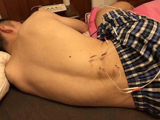 李世鑫接受腰部伤病治疗。
