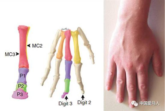 ▲ 马蹄和人手的比较