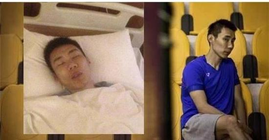 李宗伟此前的住院照曝光，不管多么先进的治疗技术，从癌症中恢复都是一个长期过程，但奥运会并不等人。