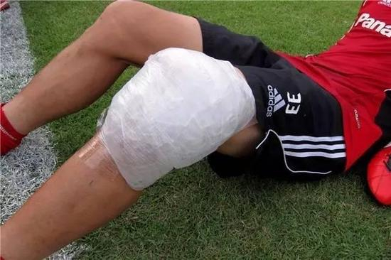 冰敷是赛场受伤的常见处理方式 来自：aceptclinic
