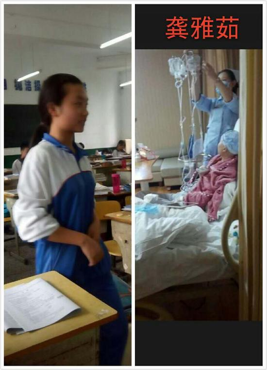 白血病患儿龚雅茹同学