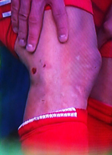 血淋淋的两个窟窿