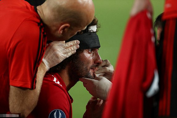 费莱尼面部出血接受包扎