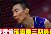 大马网友曝李宗伟患上鼻癌 官方暂未回复