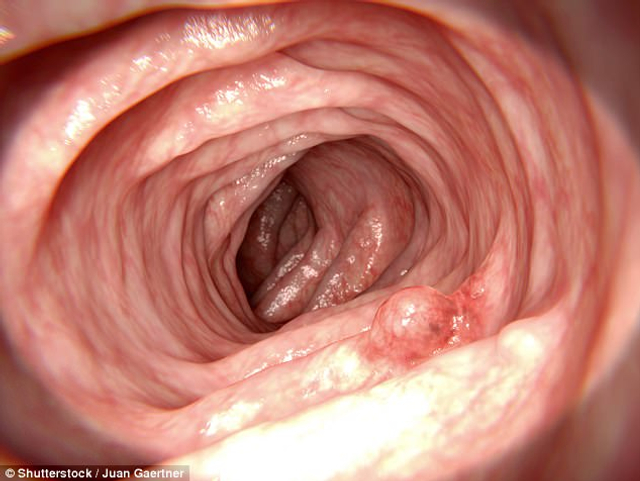 3D打印虫形机器人：未来或将帮助诊断消化道疾病