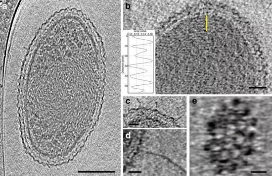  冷冻电镜下的超微小细菌，a图的标尺为100纳米，b图为50纳米