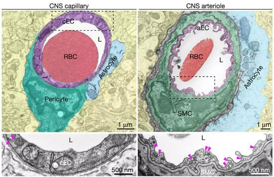 ▲&nbsp;大脑中的毛细血管（左）和动脉血管（右） 粉红色的箭头所指的就是小窝