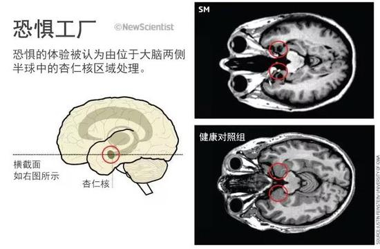 图片来源：JUSTIN FEINSTEIN UNIVERSITY OF IDWA