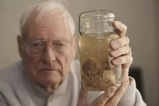 1994年时的哈维，举着一个装有爱因斯坦脑组织的玻璃罐|Getty Images