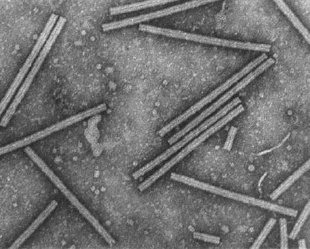 显微镜下的烟草花叶病毒。图片来源：哥伦比亚大学
